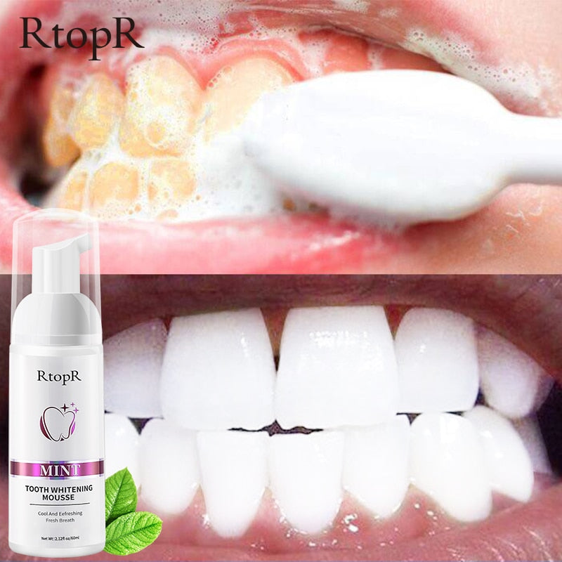 Tooth Whitening MousseSkin and SatinMy StoreThe Tooth Whitening Mousse is the perfect teeth whitening solution for a bright and attractive smile. This mousse has a gentle yet effective cleansing formula that wTooth Whitening Mousse