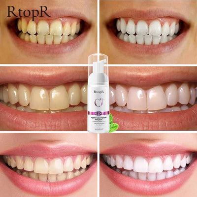 Tooth Whitening MousseSkin and SatinMy StoreThe Tooth Whitening Mousse is the perfect teeth whitening solution for a bright and attractive smile. This mousse has a gentle yet effective cleansing formula that wTooth Whitening Mousse