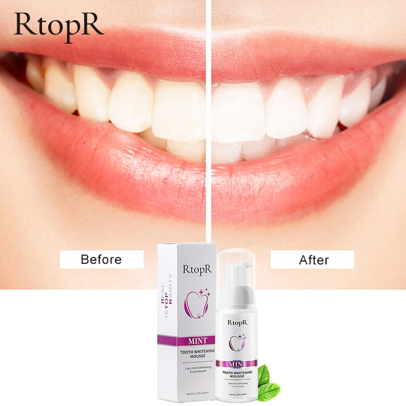 Tooth Whitening MousseSkin and SatinMy StoreThe Tooth Whitening Mousse is the perfect teeth whitening solution for a bright and attractive smile. This mousse has a gentle yet effective cleansing formula that wTooth Whitening Mousse